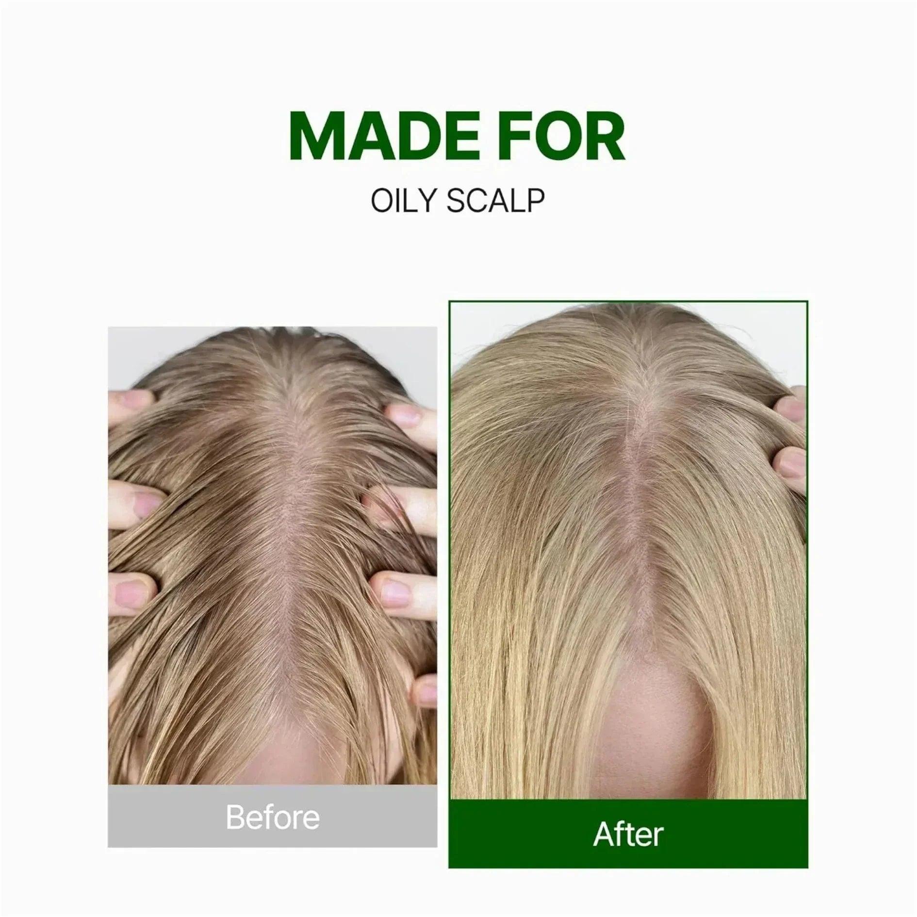 KUNDAL Tea Tree & Macadamia Pure Natural Balancing Deep Cleansing Shampoo White Musk 500ml - Orion Beauty