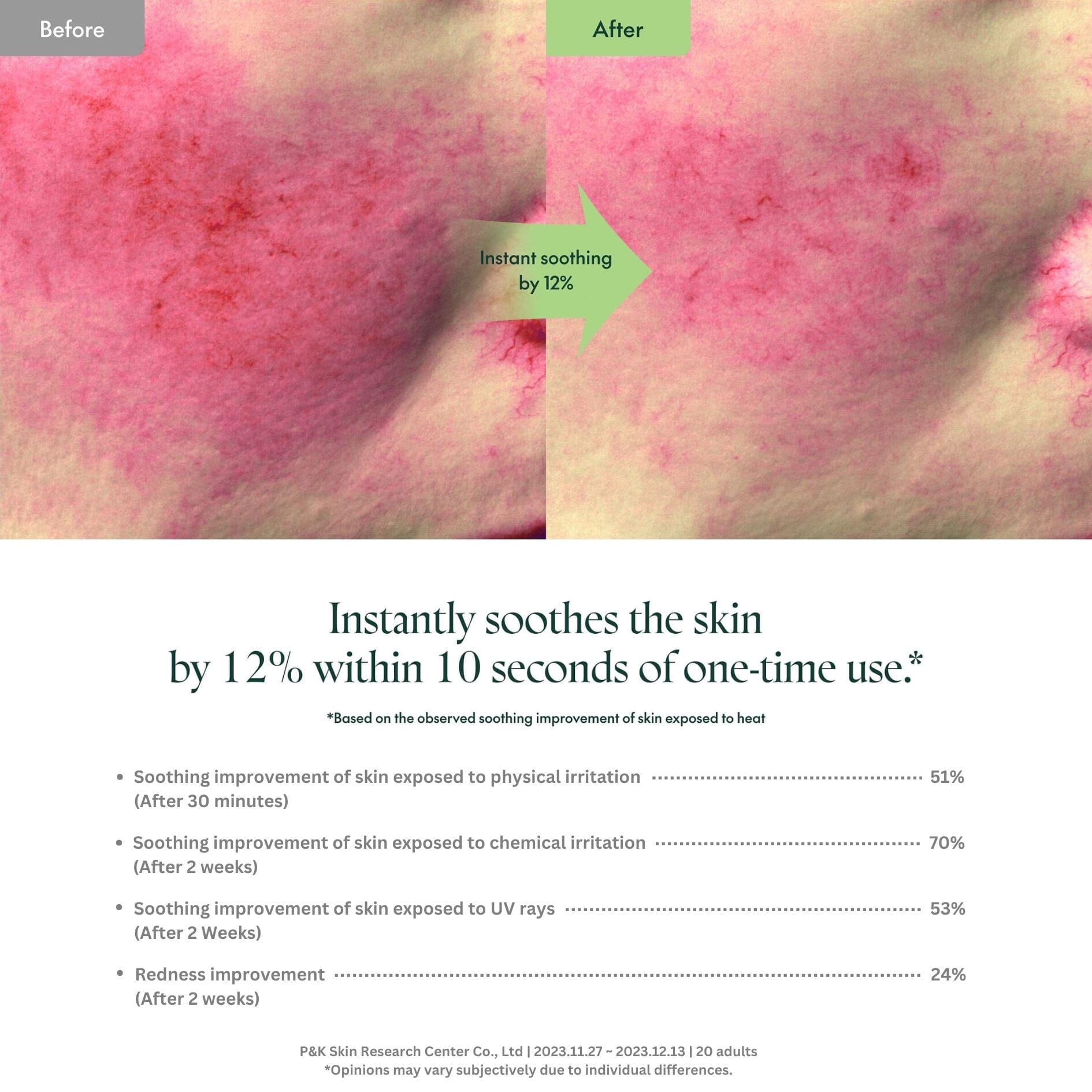 PURITO SEOUL Wonder Releaf Centella Cream Unscented 1ml (Pouch Sample), at Orion Beauty. SKIN1004 Official Sole Authorized Retailer in Sri Lanka!