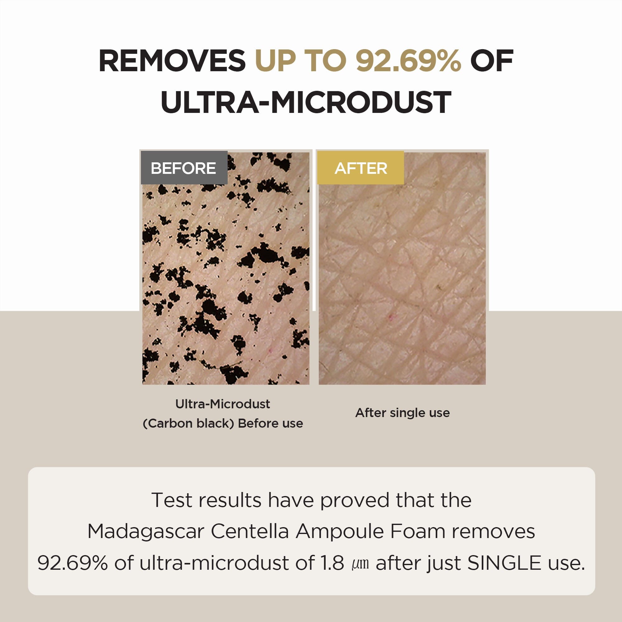 SKIN1004 Madagascar Centella Ampoule Foam 20ml, at Orion Beauty. SKIN1004 Official Sole Authorized Retailer in Sri Lanka!