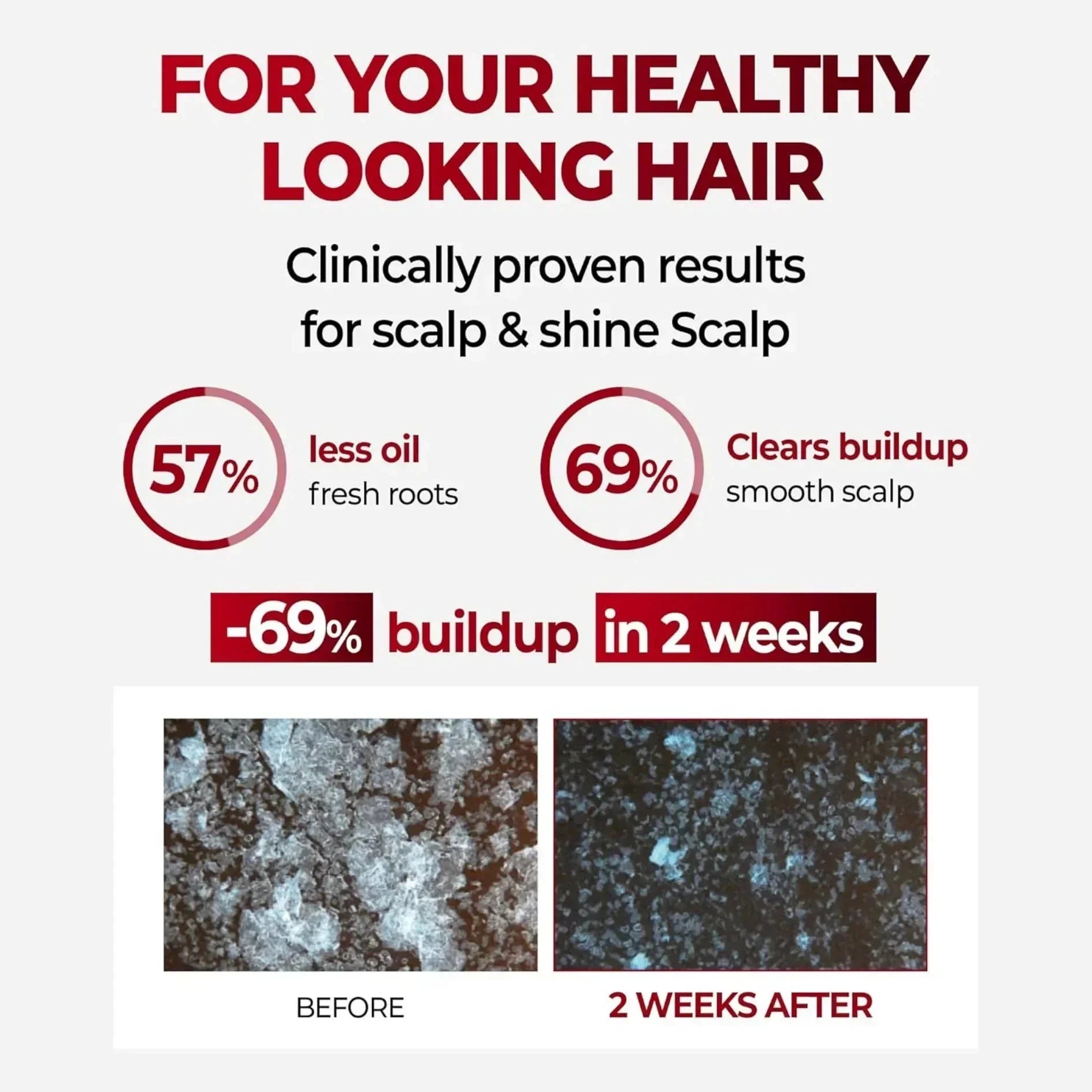 kundal-anti-hair-loss-hair-fall-control-caffeine-shampoo-500ml-all-hair-types-white-musk-hair-care-kundal-sri-lanka-orion-beauty-kundal-official-sole-authorised-reseller-897063 - Orion Beauty