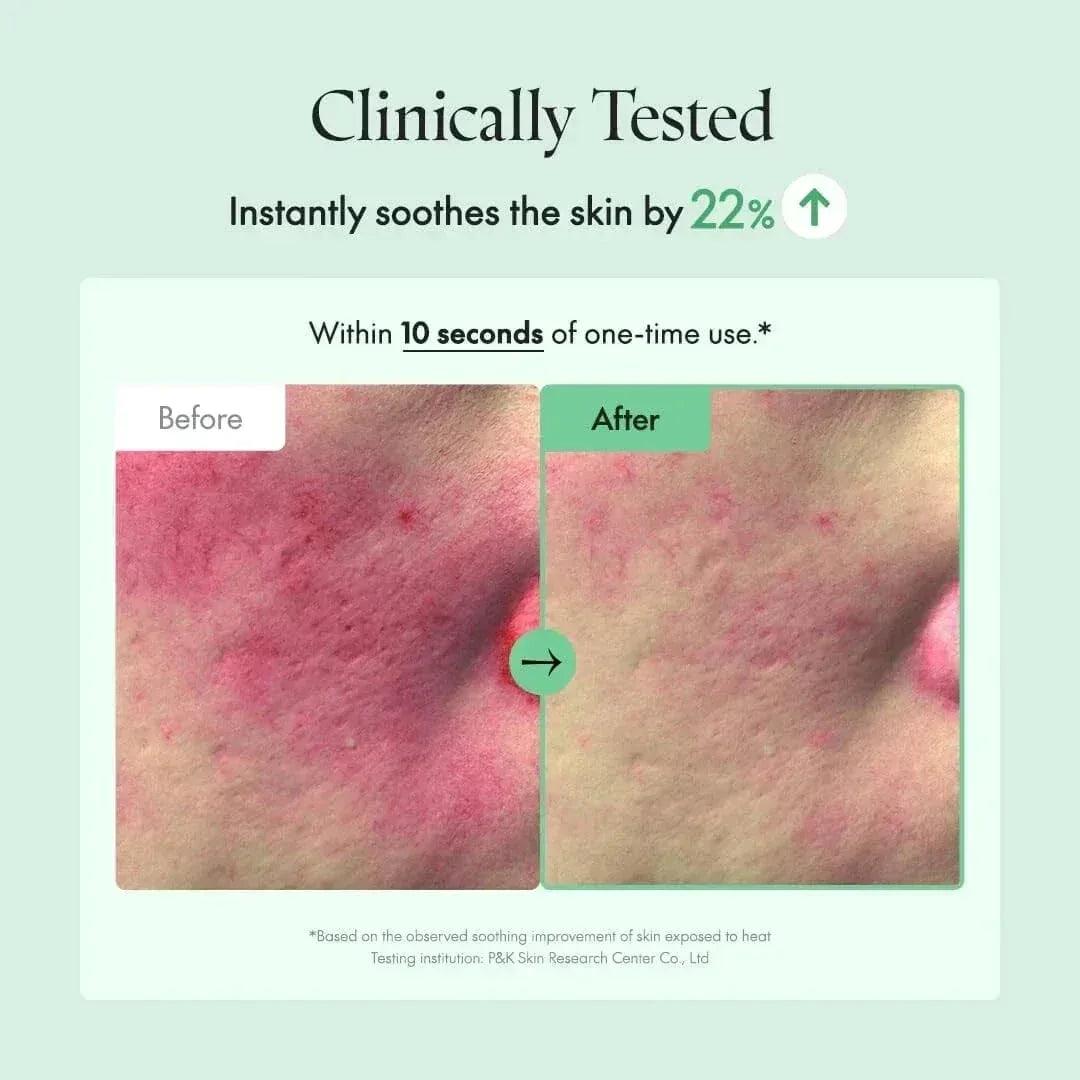 purito-seoul-wonder-releaf-centella-serum-unscented-mini-15ml-skin-care-purito-sri-lanka-orion-beauty-purito-official-sole-authorised-reseller-992445 - Orion Beauty