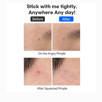 tiam-surprise-b-patch-pack-of-2-skin-care-tiam-sri-lanka-orion-beauty-tiam-official-sole-authorised-reseller-688497 - Orion Beauty
