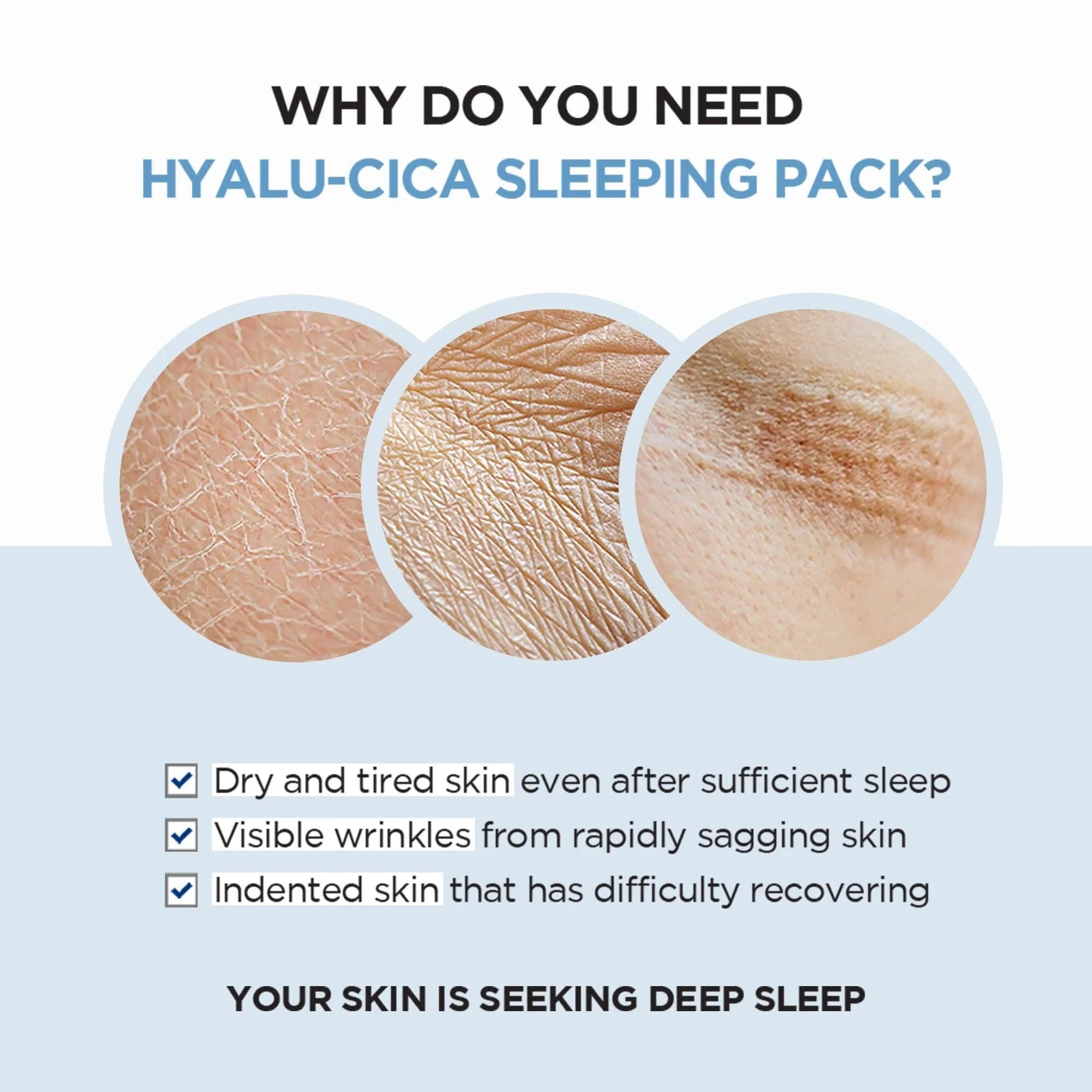 SKIN1004 Madagascar Centella Hyalu-Cica Sleeping Pack 100ml - Orion Beauty